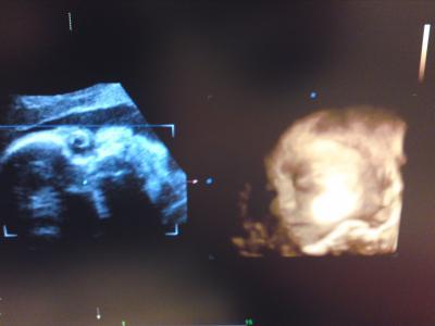 Bild zu und weil es gerade so schön ist hier unser 3D Bild :) - Forum für Januar - Mamis