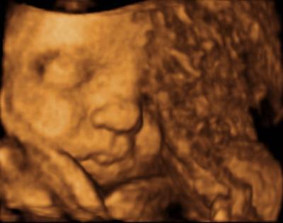 Bild zu 3 D - Bildchen von Lucy ;o) - Forum für Januar - Mamis