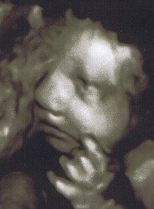 Bild zu 3D Bild von meinem Spatz - Forum für Januar - Mamis