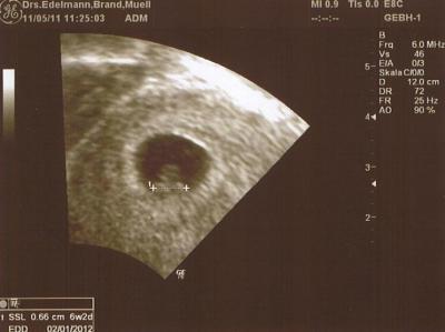 Bild zu Hier mal ein Bild von meiner Bauchmaus - Forum für Januar - Mamis