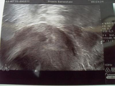 Bild zu Wieder da... - Forum für Januar - Mamis