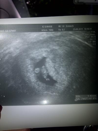 Bild zu US Bild in der 8 SSW - Forum für Januar - Mamis