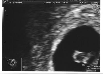 Bild zu Langersehnter Termin beim FA :) - Forum für Januar - Mamis