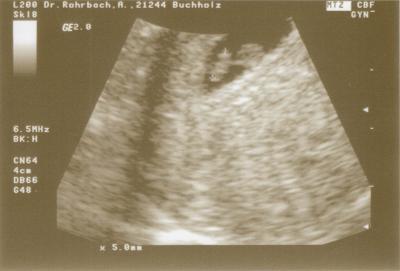 Bild zu Bin heute auch bei FA gewesen!! - Forum für Januar - Mamis