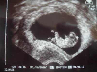 Bild zu mein besuch bei 10+2 - Forum für Januar - Mamis