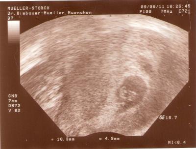 Bild zu Heutiger Termin bei meiner FÄ - Forum für Januar - Mamis