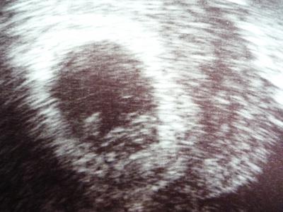 Bild zu zurück vom FA - Forum für Januar - Mamis