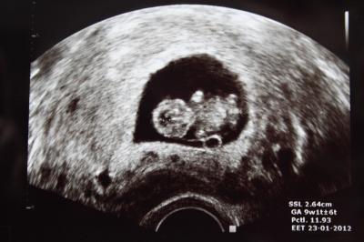 Bild zu auch FA-Termin gehabt:-) - Forum für Januar - Mamis