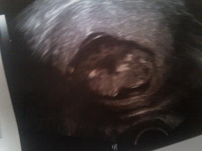 Bild zu Habe hier noch ein Foto für Euch... - Forum für Januar - Mamis