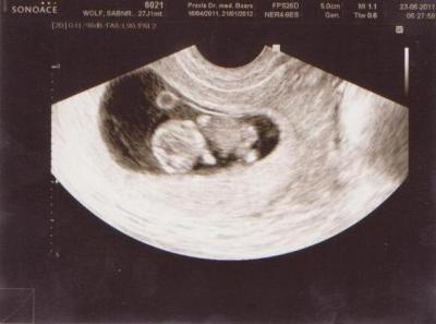 Bild zu Unser Baby - Forum für Januar - Mamis