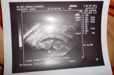 Bild zu lieber zu späääd als nie..=) - Forum für Januar - Mamis