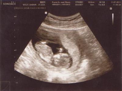 Bild zu Wie versprochen ein bild von unserem schatz!! - Forum für Januar - Mamis