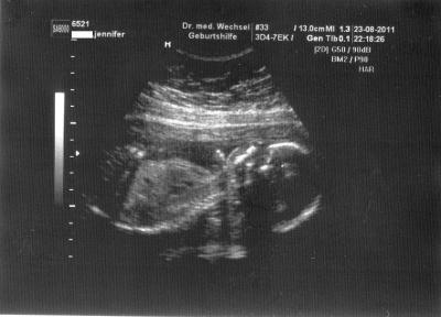 Bild zu Mein aktuelles US-Bild - Forum für Januar - Mamis
