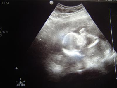 Bild zu Mein erstes Baby - Forum für Januar - Mamis