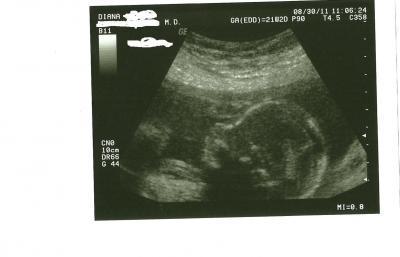 Bild zu Es ist ein...... - Forum für Januar - Mamis
