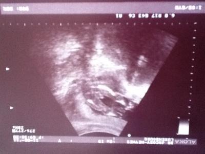 Bild zu @Sandyyy: US-Bilder - Forum für Januar - Mamis
