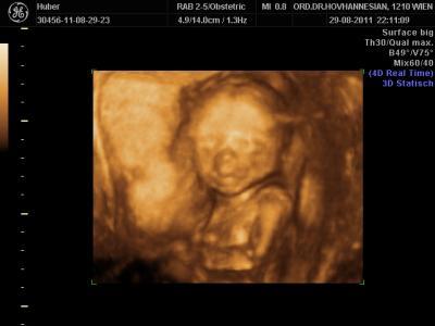Bild zu endgültiges Outing und Namensschreibung - Forum für Januar - Mamis