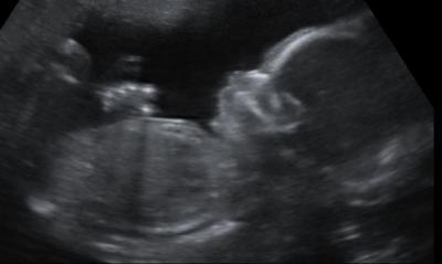 Bild zu Feindiagnostik - Forum für Januar - Mamis