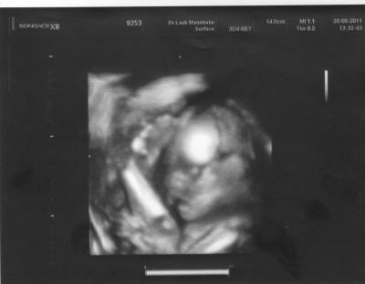Bild zu 3D Bild - Forum für Januar - Mamis