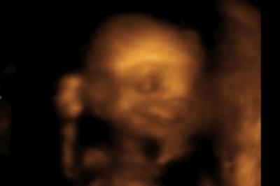 Bild zu Babyfacing - Forum für Januar - Mamis