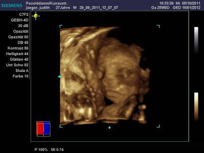 Bild zu 3D-Foto, diesmal hats geklappt - Forum für Januar - Mamis