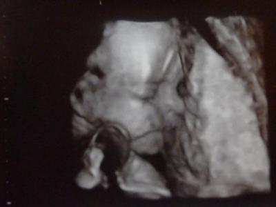 Bild zu gestern Fa alles bestens mit 3d foto - Forum für Januar - Mamis