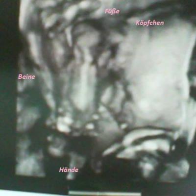 Bild zu Bericht und Bilder vom FA Termin gestern ;-) - Forum für Januar - Mamis