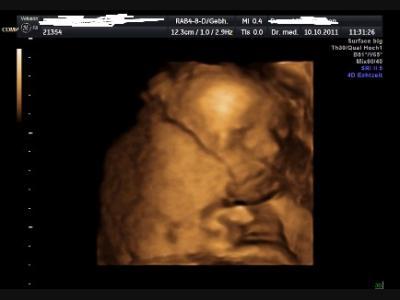 Bild zu Unsere Tochter - Forum für Januar - Mamis