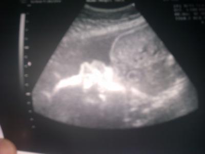 Bild zu VU =) und eine Überraschung + Bildchen - Forum für Januar - Mamis