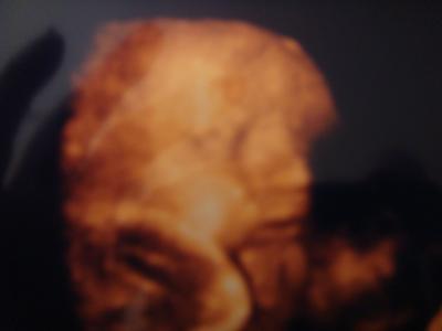 Bild zu meine ersten 3D Bilder vom kleinen Antonio - Forum für Januar - Mamis