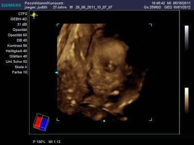 Bild zu Bericht vom 3.Screening - Forum für Januar - Mamis