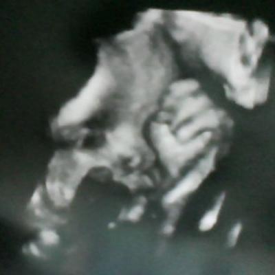 Bild zu Bericht vom Arzt Termin gestern Abend  Plus Bildchen ;-) - Forum für Januar - Mamis