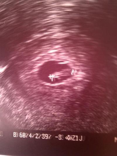 Bild zu Mein Fa Termin - Forum für Januar - Mamis