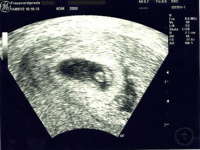 Bild zu Ich fahre auch mit :) - Forum für Januar - Mamis