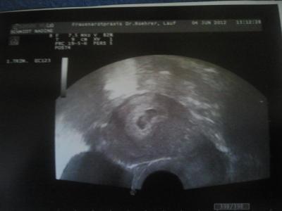 Bild zu Erste Bilder - Forum für Januar - Mamis