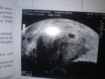 Bild zu muss hier auch mal heulen kann mir jemand mut machen ;( sorry etwas lang - Forum für Januar - Mamis