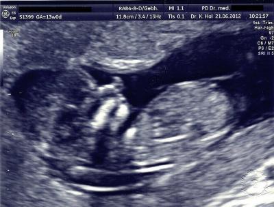 Bild zu Endlich mal wieder Zeit :) - Forum für Januar - Mamis