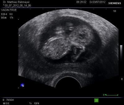 Bild zu Auch zurück vom FA incl. Bilder ;) - Forum für Januar - Mamis