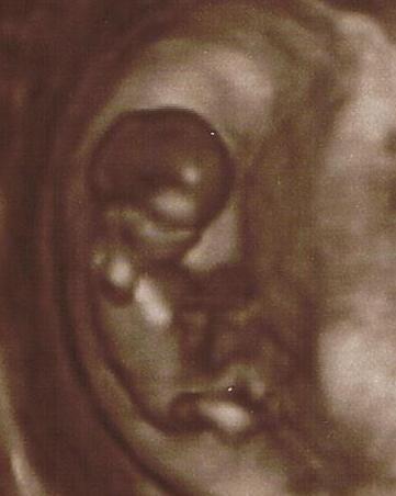 Bild zu Ultraschallfoto - Forum für Januar - Mamis