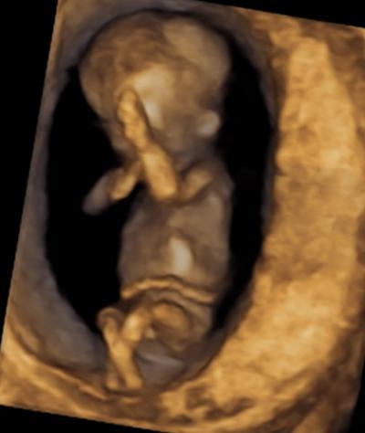 Bild zu Heute bei der Pränataldiagnostik... - Forum für Januar - Mamis