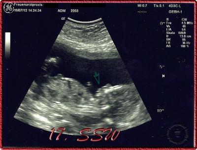 Bild zu Zurück von der Vorsorge-Untersuchung :) - Forum für Januar - Mamis