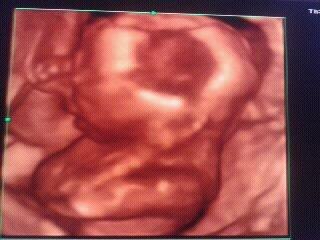 Bild zu Habt ihr Bilder von euren kleinen? Her damit ;) (ich hab ein 3D Bild) - Forum für Januar - Mamis