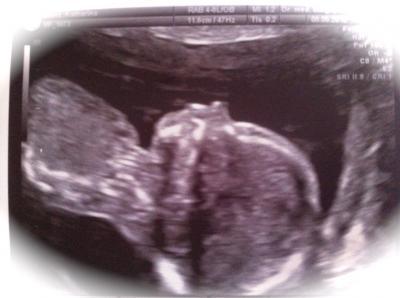 Bild zu Mein kleiner Prinz - Forum für Januar - Mamis