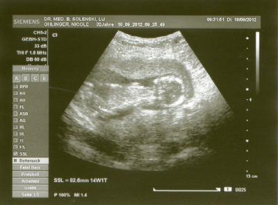 Bild zu Heute Termin gehabt + Bildchen - Forum für Januar - Mamis