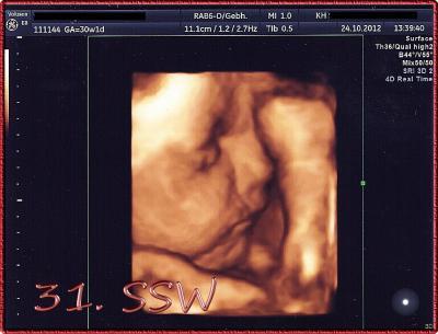 Bild zu Ergebnisse VU und Doppler-US mit Foto :) - Forum für Januar - Mamis