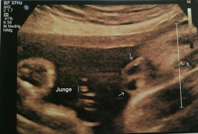 Bild zu Mein letztes US-Bild! - Forum für Januar - Mamis