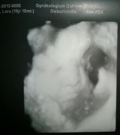 Bild zu Und hier noch ein Foto von meim Kleinen =) - Forum für Januar - Mamis