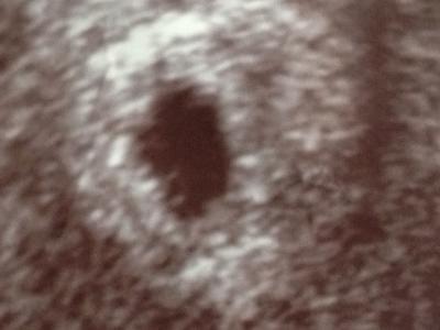 Bild zu Ultraschall von heute - Forum für Januar - Mamis