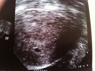 Bild zu Zurück vom Frauenarzt mit Foto :) - Forum für Januar - Mamis