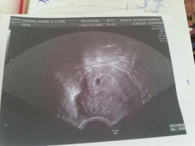 Bild zu erster Termin beim arzt - Forum für Januar - Mamis